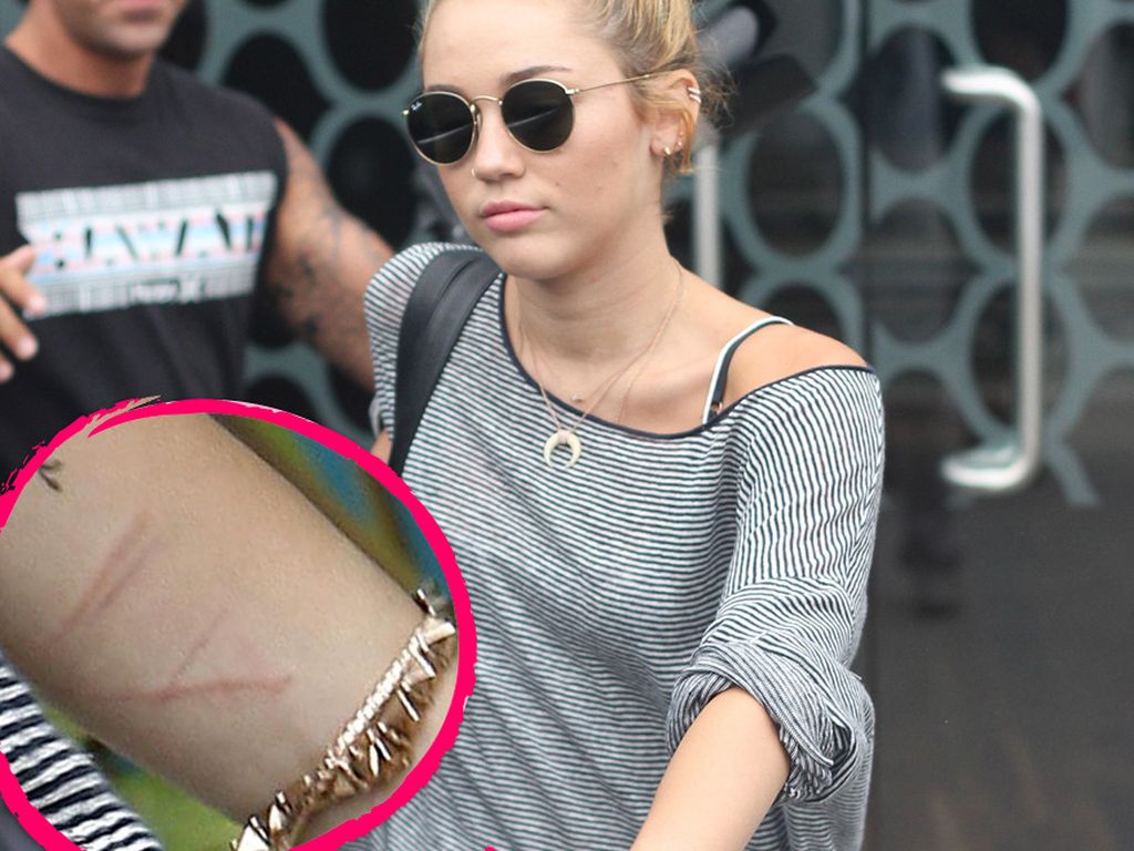 miley cyrus so schlimm sehen ihre arm narben aus miley cyrus so schlimm sehen ihre arm narben aus