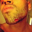 Chris Brown trug von der angeblichen Auseinandersetzung eine Wunde am Kinn davon