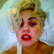 So schlimm sieht Lady GaGa derzeit aus 