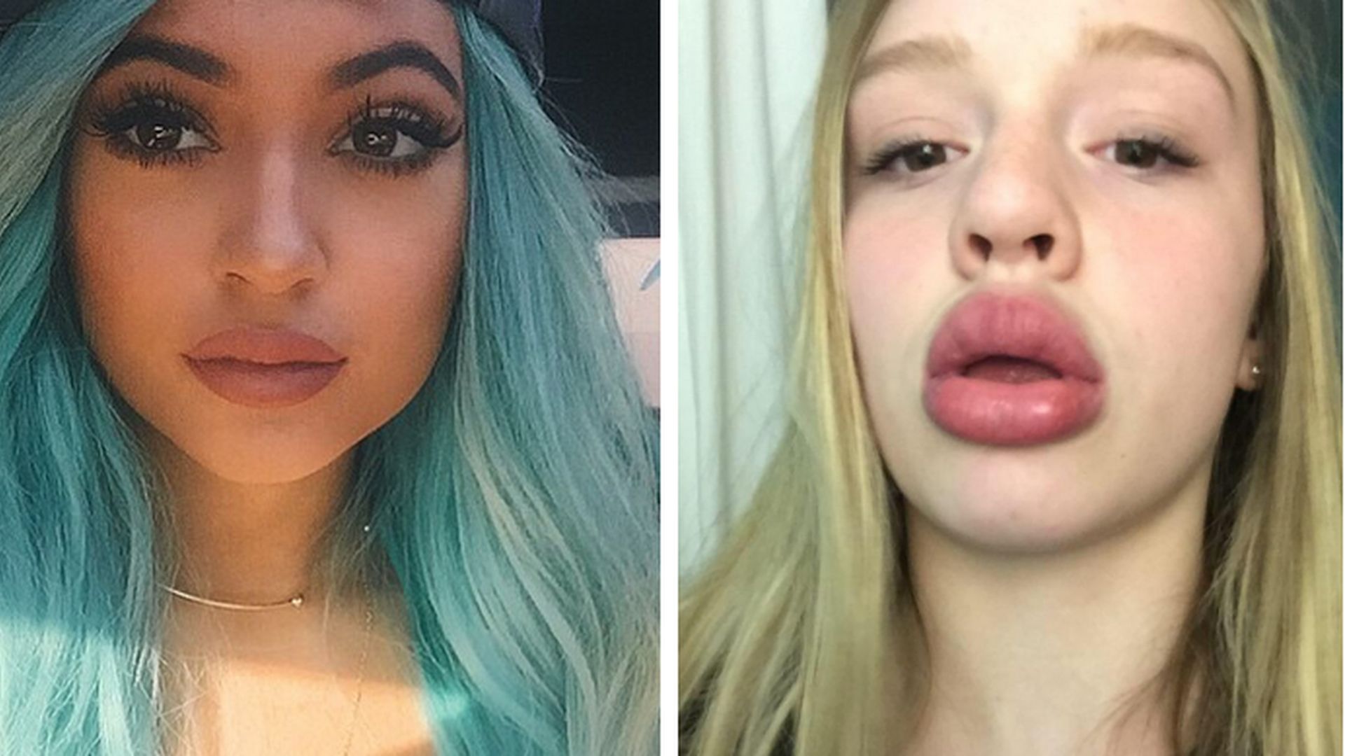XXLLippen Kylie Jenner löst SchockerChallenge aus Promiflash.de