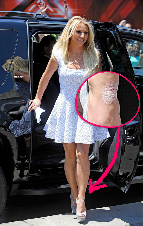 Britney Spears hat einen komischen Fleck am Fußrücken Britney Spears hat einen komischen Fleck am Fußrücken
