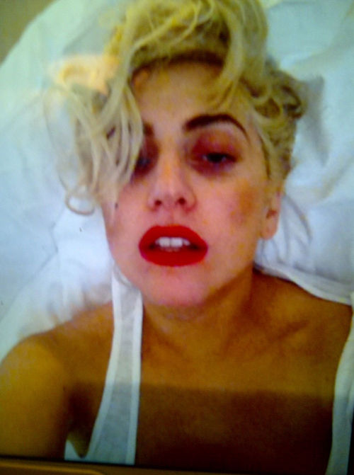 So schlimm sieht Lady GaGa derzeit aus So schlimm sieht Lady GaGa derzeit aus