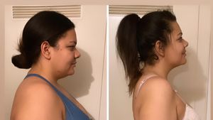 Magenverkleinerung: "Biggest Loser"-Chanté stolz auf Körper