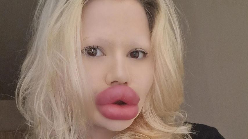 Neben XXL-Lippen: Andrea Ivanova plant neue Beauty-Projekte