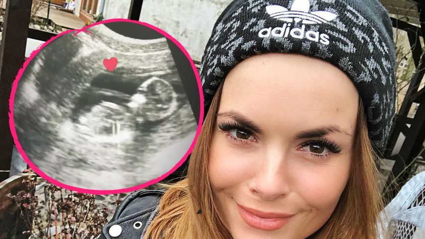Intimer Einblick: Denise Temlitz zeigt ihr Baby im Bauch
