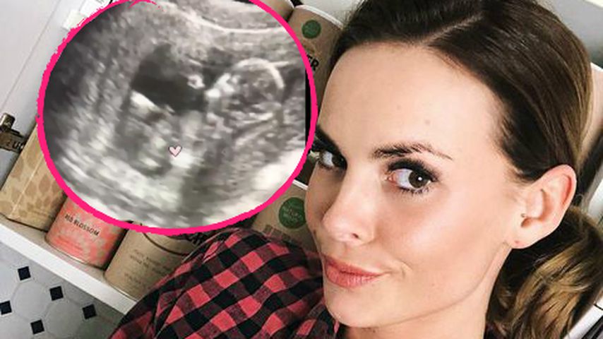 Da ist der Baby-Boy! Denise Kappés zeigt Ultraschall-Clips