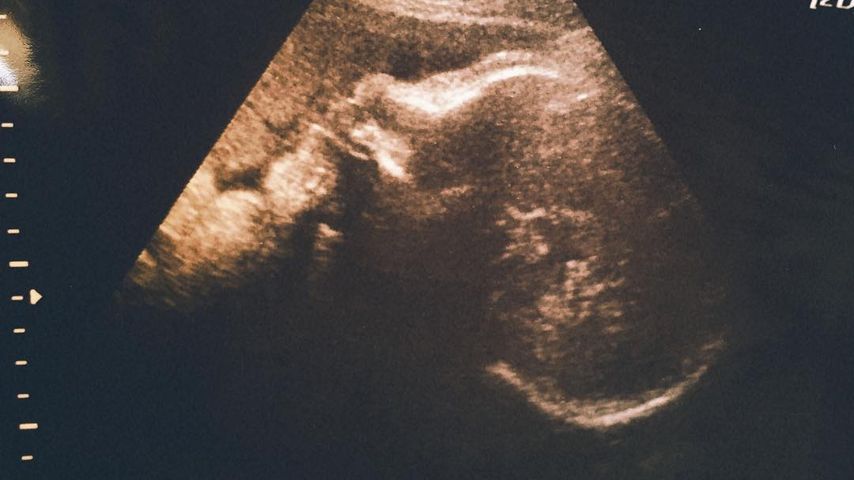 Holly Madison zeigt ein Ultraschallbild ihres Sohnes