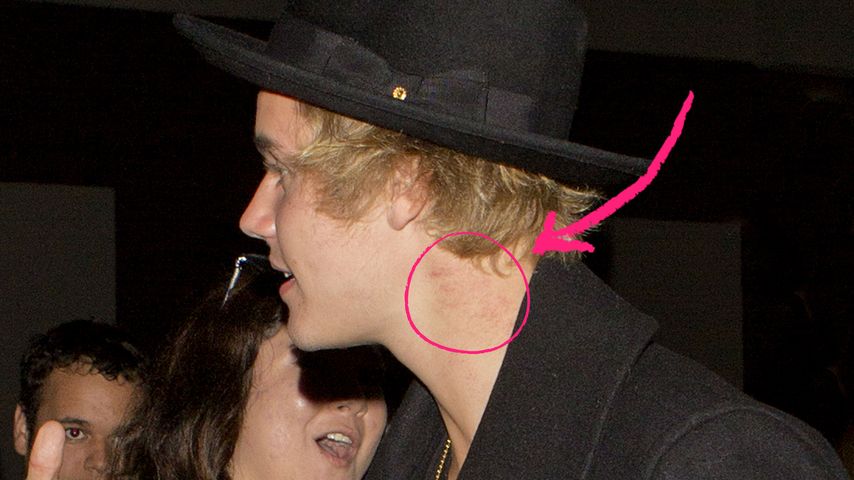 Justin Bieber