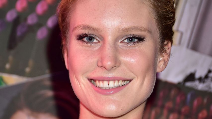 Pickel-Alarm: Kim Hnizdo offenbart Perioden-Problem!