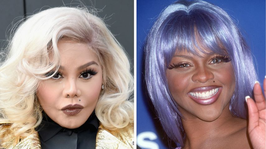Mega-Fail: Die 5 schlimmsten Beauty-OPs der Stars!