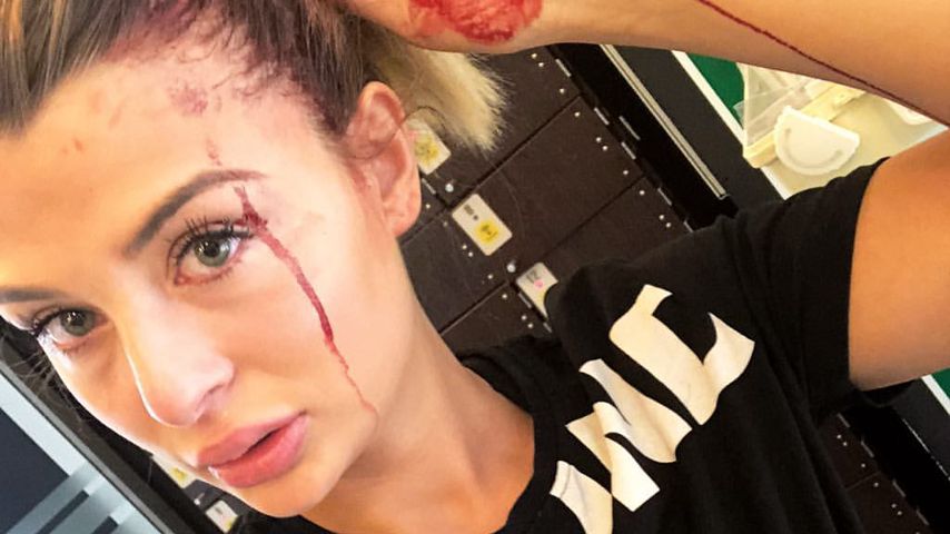 Nach blutigem Gym-Unfall: Lisa G. gibt ihren Fans Entwarnung