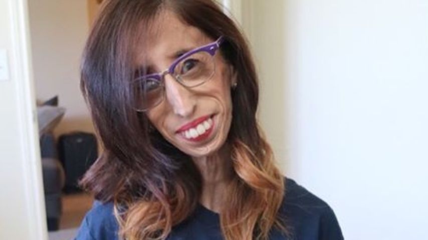 Lizzie Velasquez