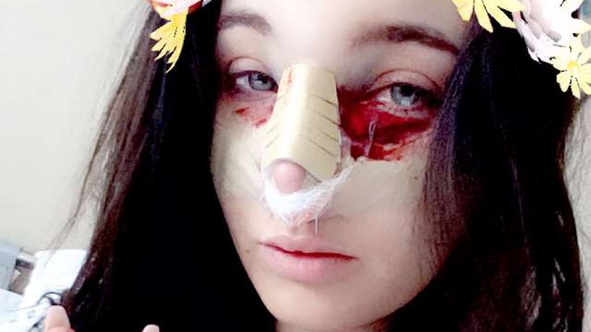 Melody Haase nach Beauty-OP