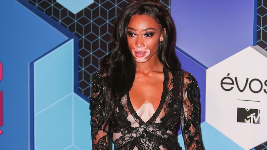 Model Winnie Harlow bei den MTV EMAs 2016