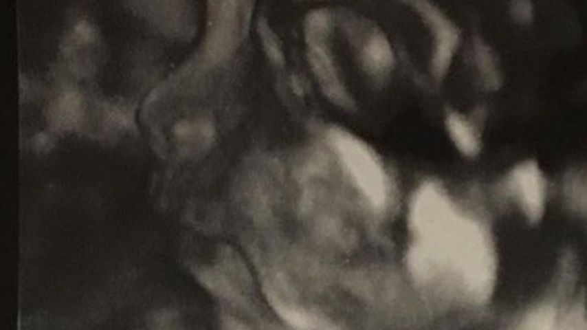 Robert Kardashians und Blac Chynas Baby auf einer Ultraschall-Aufnahme