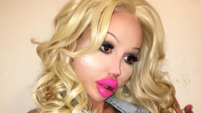 Beauty-OPs übertrieben: Sammy Vees Lippen kurz vorm Platzen