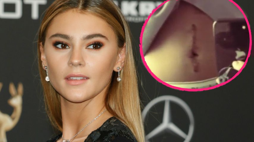 Ohne Verband: Steffi Giesingers OP-Wunde sieht besser aus