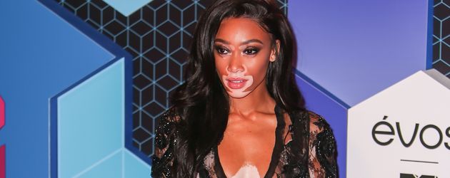 Model Winnie Harlow bei den MTV EMAs 2016 Model Winnie Harlow bei den MTV EMAs 2016