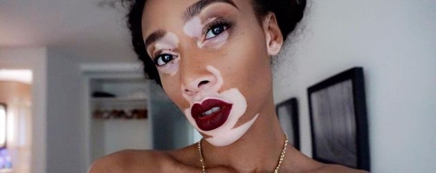 Winnie Harlow in London Winnie Harlow in London